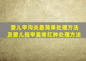 婴儿甲沟炎最简单处理方法及婴儿指甲盖旁红肿处理方法